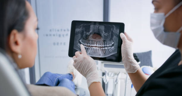 Licensed Tooth Extraction service in Hilliard, OH - Smile Center Dentistry